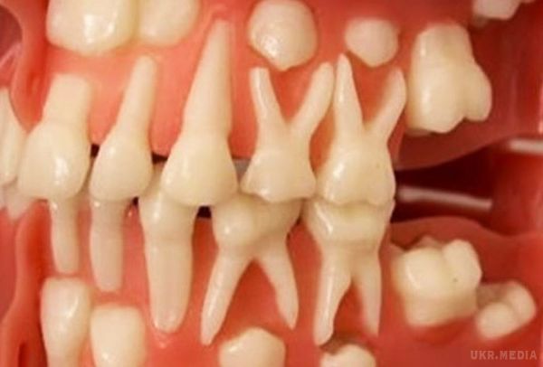 Ви можете виростити нові зуби самостійно за 9 тижнів. Неймовірне відкриття професора стоматології .