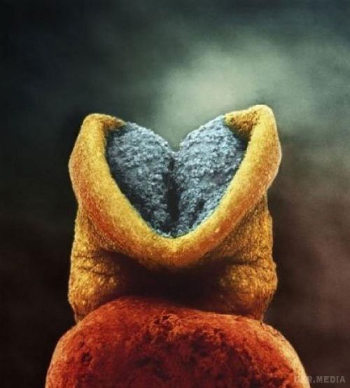 Еволюція ембріона: Як народжується людина. Ці фото були зроблені за допомогою мікроскопа. Здогадайся, що це! Просто витвір мистецтва.