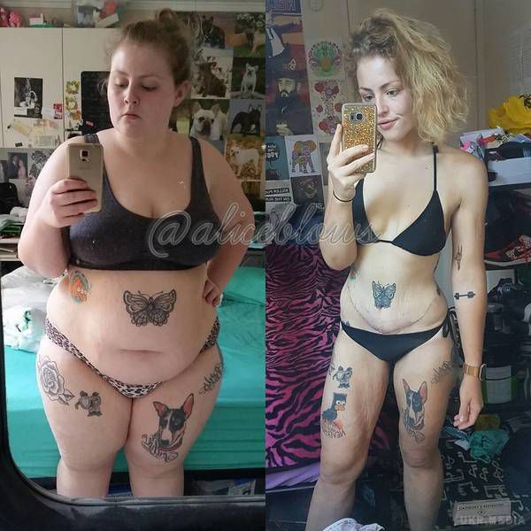 Ця дівчина важила 135 кілограмів, але її нова зовнішність вас здивує. 23-річна Аліса Толмен з Мельбурна була шалено залежною від їжі, тому й почала різко набирати вагу.
