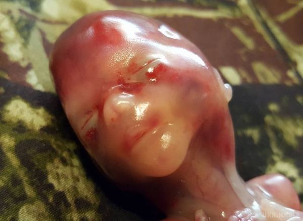 Фото, доводить, що аборт дорівнює вбивству. Як виглядає малюк в 14 тижнів життя.
