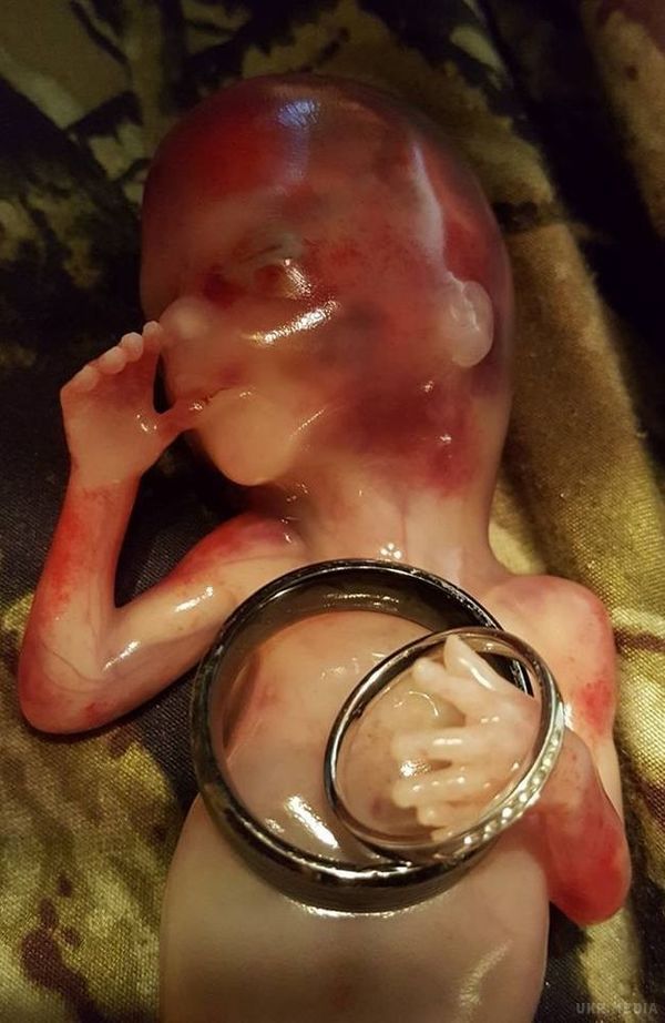 Фото, доводить, що аборт дорівнює вбивству. Як виглядає малюк в 14 тижнів життя.
