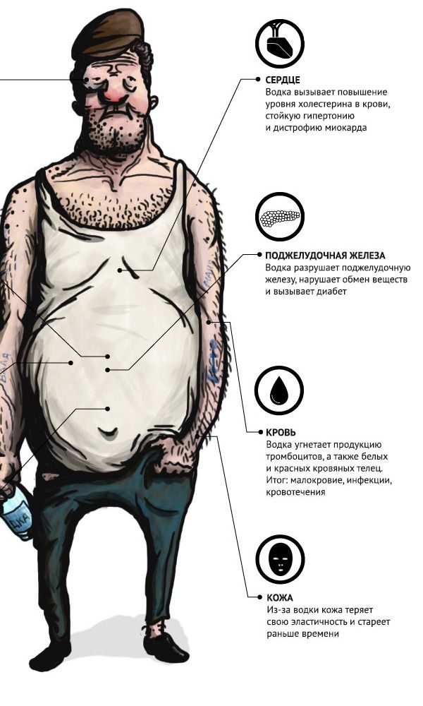 Інфографіка, як горілка впливає на організм людини. Важка доля в алкоголіка!
