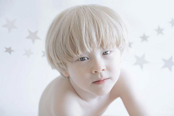 Люди, які відрізняються чарівною красою від інших (Фото). Білосніжна краса людей-альбіносів у чарівних творчих фотографіях.