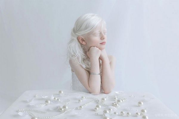 Люди, які відрізняються чарівною красою від інших (Фото). Білосніжна краса людей-альбіносів у чарівних творчих фотографіях.