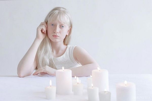 Люди, які відрізняються чарівною красою від інших (Фото). Білосніжна краса людей-альбіносів у чарівних творчих фотографіях.