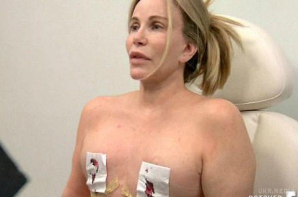  Тауни Кітен після 6 операцій на грудях видалили імплантати з допомогою п'явок(відео). Тауни зробила шість операцій по збільшенню грудей, але врешті-решт вирішила зовсім позбутися імплантатів, тому що почала відчувати труднощі з власною груддю.