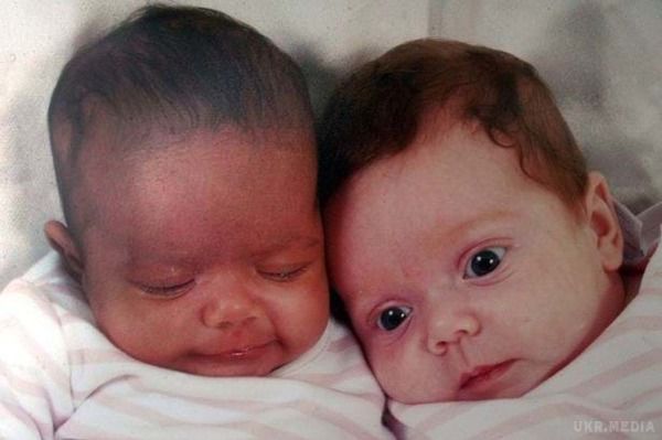У Британії ростуть рідні сестри з різним кольором шкіри. Не вірять, що ми близнюки:Міллі і Марсія Біггс з'явилися на світ завдяки ЕКО.