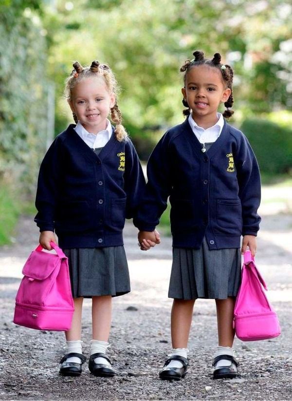 У Британії ростуть рідні сестри з різним кольором шкіри. Не вірять, що ми близнюки:Міллі і Марсія Біггс з'явилися на світ завдяки ЕКО.
