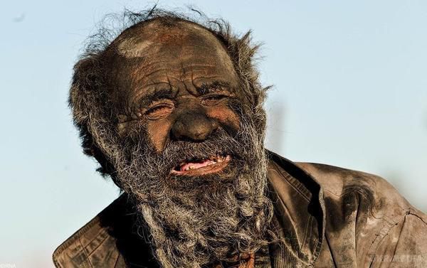Як виглядає людина, яка 60 років не милася. Його шкіра покрита лусочками бруду, очей майже не видно, а сморід від нього відчувається за версту.