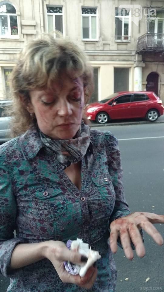 В Одесі побили активістку Аліну Радченко. Невідомий підбіг до жінки і, зваливши її з ніг одним ударом, почав бити.