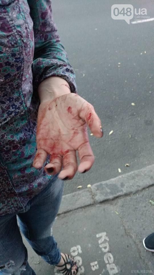 В Одесі побили активістку Аліну Радченко. Невідомий підбіг до жінки і, зваливши її з ніг одним ударом, почав бити.