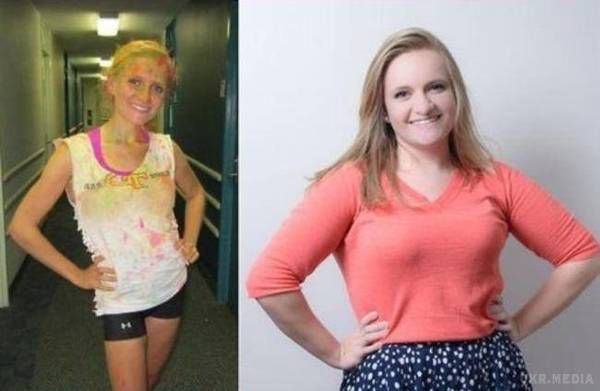 Чудові знімки людей, які перемогли анорексію (Фото) - До і після. Приклади чудесного відновлення людей, страждаючих анорексією.
