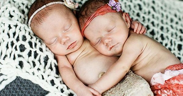 Ці близнюки народилися тримаючись за руки...Подивіться, що з ними зараз! (фото). Народилися два роки тому близнюки Дженна і Джилліан уславилися по всьому світу. Справа в тому, що дівчатка народилися, тримаючи одна одну за руки. 