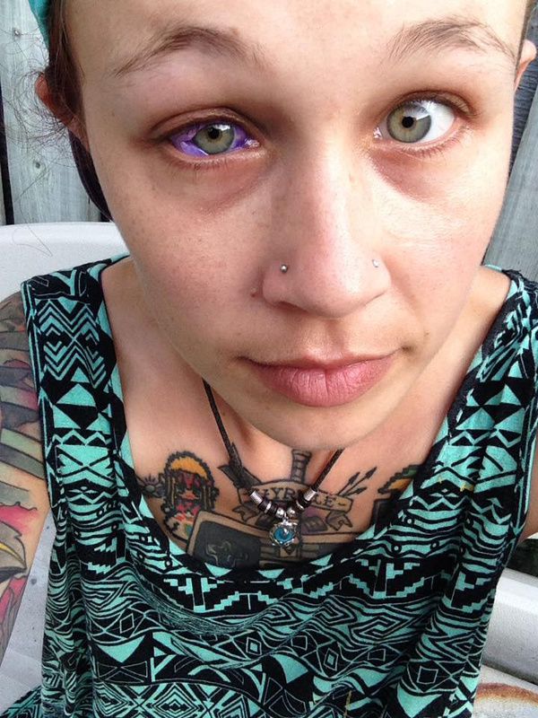 Дівчина зробила невдале татуювання білка ока і виклала моторошні фото в Мережу. Здавалося б, що могло піти не так?