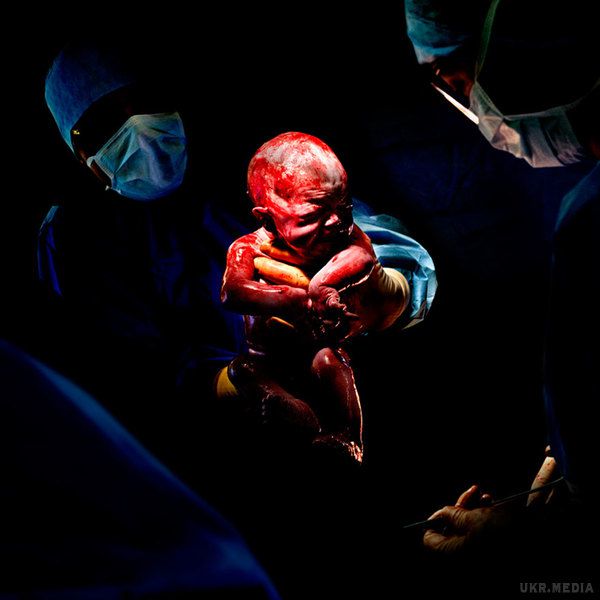 Неймовірні кадри немовлят через секунди після народження (Фото). Підбірка відкриває нам реальну картину пологів, відкидаючи звичні ковдри і пелюшки, показуючи, якими ми були, коли тільки народилися.