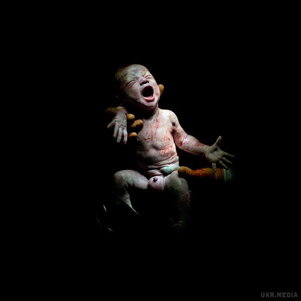 Неймовірні кадри немовлят через секунди після народження (Фото). Підбірка відкриває нам реальну картину пологів, відкидаючи звичні ковдри і пелюшки, показуючи, якими ми були, коли тільки народилися.
