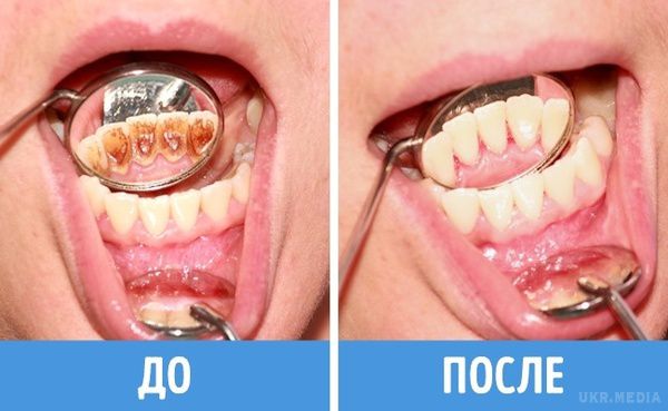 8 помилок у догляді за зубами, які робить кожен з нас. Ми сумніваємося, що хтось із вас не чистить зуби вранці, але цього, насправді, зовсім не достатньо.