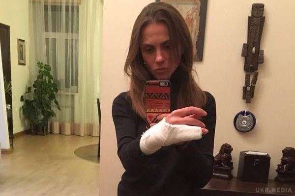 Київські поліцейські зламали руку жінці: з'явилося відео. В авто в цей час перебували двоє неповнолітніх дітей.