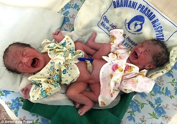 В Індії народилися сіамські близнюки незрозумілого статі!. 32-річна мама народила двох дітей самостійно.