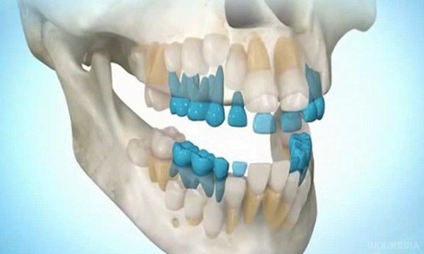 Тепер ви можете виростити власні зуби за 9 тижнів. Стоматологи придумали багато всього нового і зробили величезний крок вперед у порівнянні зі звичайними зубними протезами та імплантатами,