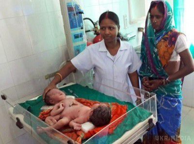 Чому і як часто сіамські близнюки народжуються на нашій планеті?. В Індії народилася дитина з двома головами.