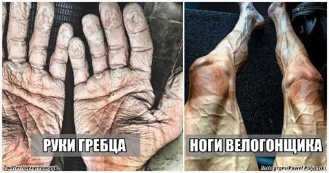 Спортсмени показали ціну успіху —  оторопіли абсолютно всі !!!. Нікого не цікавить форма спортсмена — всім потрібні рекорди. 
