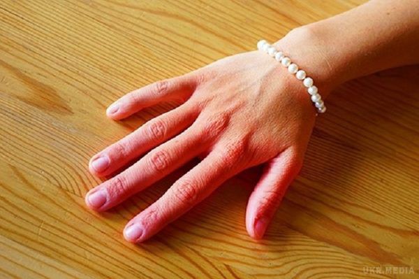Небезпечні захворювання, про які сигналізують  руки!. Як часто ви помічали, що у вас тремтять або набрякають руки? 