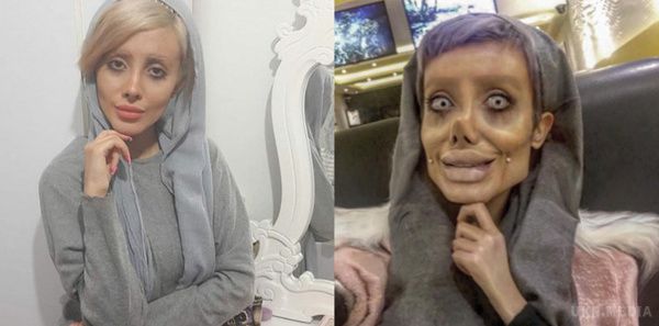 Жінка з Ірану зробила 50 операцій, щоб стати схожою на Анджеліну Джолі. Тепер її фотографіями можна лякати дітей!