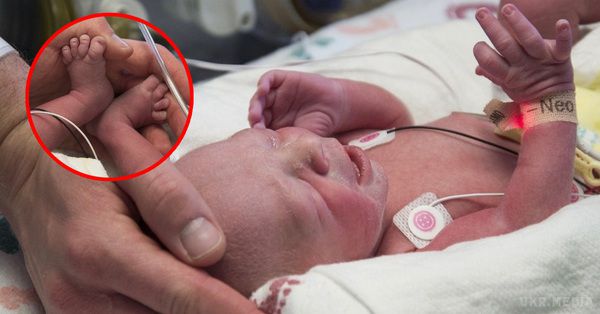 Це перша у світі дитина, народжена таким способом. Подія, що сколихнула світ медицини!