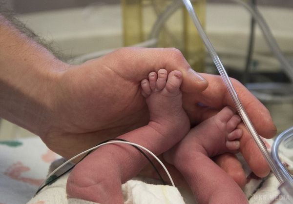 Це перша у світі дитина, народжена таким способом. Подія, що сколихнула світ медицини!. Американські лікарі зробили диво.