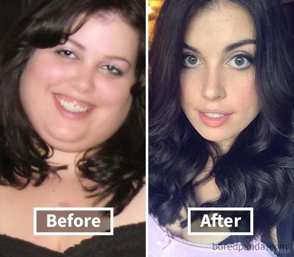 Дивовижні фото до і після схуднення, що показують, як втрата ваги змінює ваше обличчя. Дуже мотивуюче!
