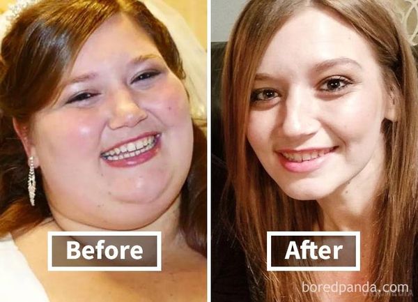 Дивовижні фото до і після схуднення, що показують, як втрата ваги змінює ваше обличчя. Дуже мотивуюче!