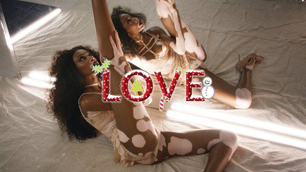 Модель з рідкісною хворобою знялася в спокусливому ролику для Love Magazine. Love Magazine щорічно публікує календар з коротких пікантних відео, в якому знялися відомі моделі сучасності.