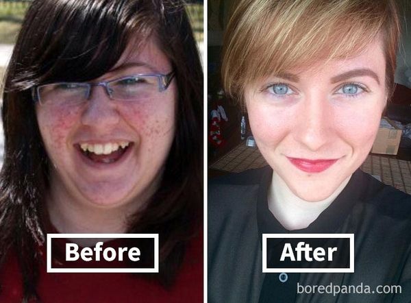 25 людей до і після схуднення, що показують, як втрата ваги змінює ваше обличчя. Вони стали зовсім іншими людьми.
