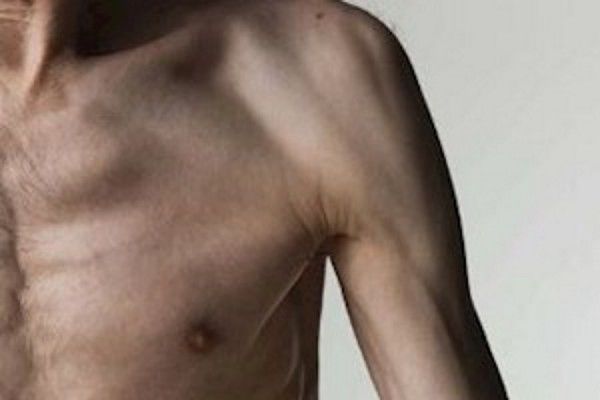 М'язи при м'язовій дистрофії можна регенерувати. Вчені.