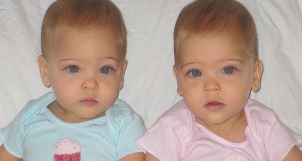 Коли народилися ці малятка мама вважала їх найкращими. Сьогодні вони визнані найкрасивішими близнюками в світі!