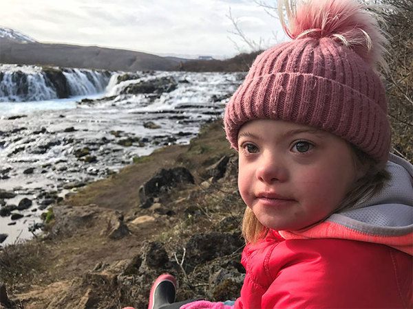 Два в рік — це рекорд. В Ісландії майже не народжуються діти із синдромом Дауна. Синдром Дауна — це генетична аномалія, вроджена хвороба, яку викликає наявність додаткової, 47-ї хромосоми, передає Ukr.Media. На жаль, він не є рідкістю, приблизно кожен 700-ї дитина народжується з відхиленням.