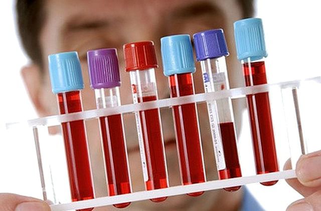 Одразу 8 видів раку можуть бути діагностовані за допомогою нового аналізу крові. Дослідники з Медичної школи Університету Джонса Хопкінса розробили тест для точної діагностики раку,