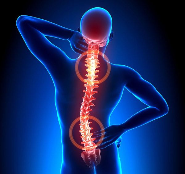 Терпіти біль — остання справа! Комплекс диво-вправ з знеболюючим ефектом від остеохондрозу. Як позбавитися від болю в спині