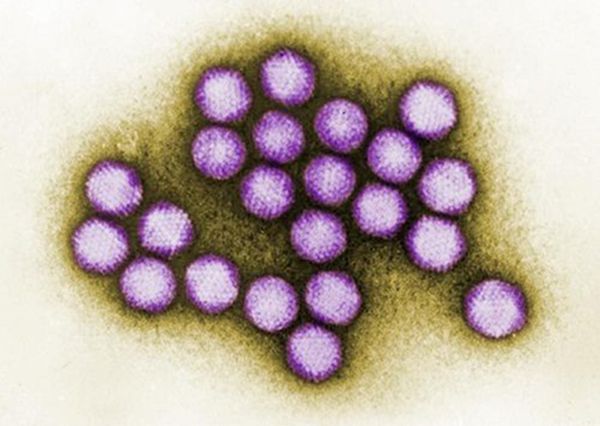 Новий вірус виглядає як грип, веде себе як грип, але це не він!. Ви зобов'язані це знати.