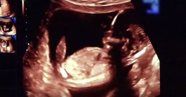 Кайлі Дженнер поділилася першими кадрами з новонародженою дочкою. Відео.