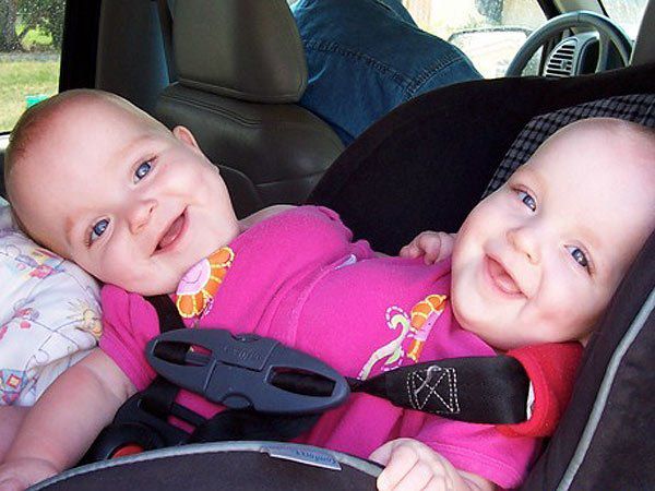 Сіамськи близнюки: цих крошок розділили у 9 місяців. Їм вже по 14 років! (фото). Зараз дівчаткам по 14 років. Як і інші підлітки, вони повні життя, енергії та завзяття.