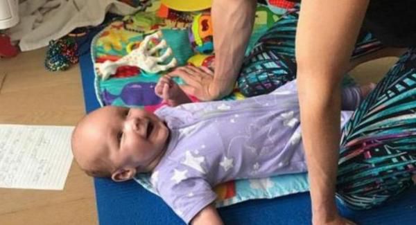 В Австралії дівчинка народилася "дорослою" через рідкісну хворобу. Дочці Лорен Фаінгаа з Мельбурна в віці п'яти тижнів діагностували синдром Сотоса.
