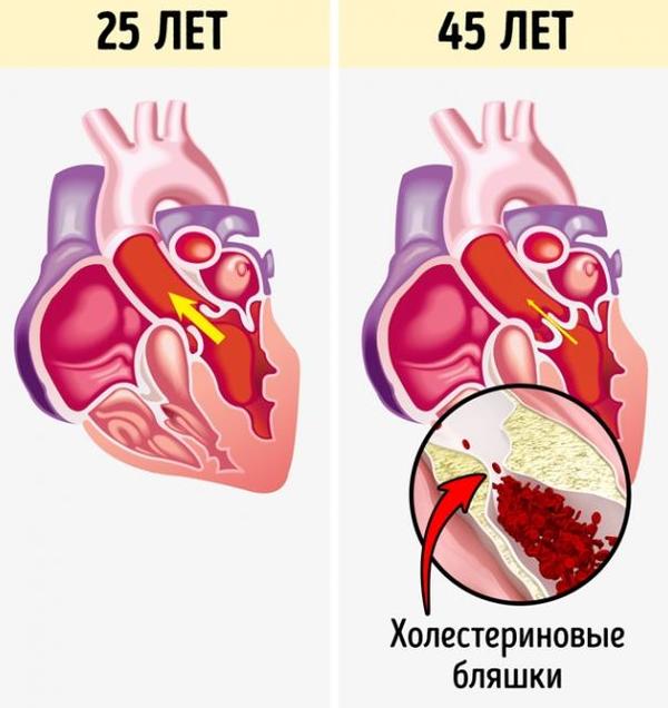 Що відбуваються з вашим тілом, якщо ви сидите по 8 годин на день!!!.  Ви повинні це знати!