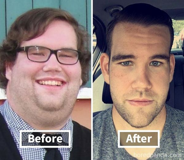 Дивовижні знімки до і після схуднення, що показують, як втрата ваги змінює ваше обличчя. Багато хто з нас могли б отримати вигоду з втрати пари зайвих кілограмів.