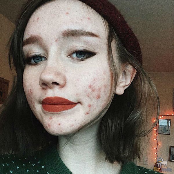 Б'юті-блогер зважилася показати шкіру, яку вона ховала під макіяжем. 18-річна Хейлі Вейт (Hailey Wait) веде б'юті-в блог Instagram. Дівчина набирає популярність завдяки своїй лялькової зовнішністі: порцелянова шкіра, величезні блакитні очі, пухкі губи.