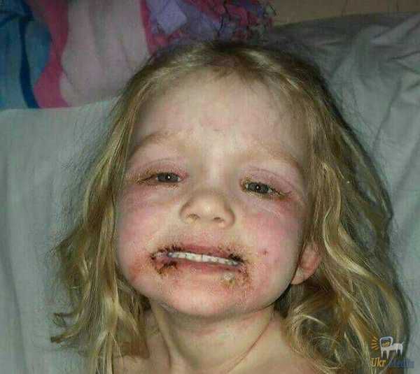 3-річна дівчинка потрапила у лікарню через популярну іграшку. Її мати попереджає