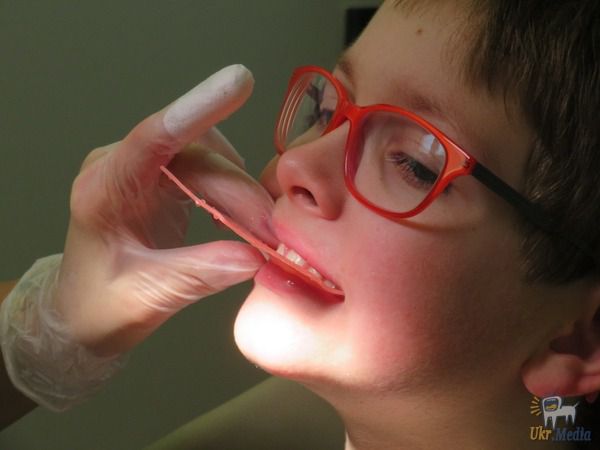 Причини появи кривих зубів у дітей: як виправити, профілактика. Красиві рівні зуби додають людині чарівності. Те, що заважає зубах правильно рости, набагато легше виправити в дитинстві.