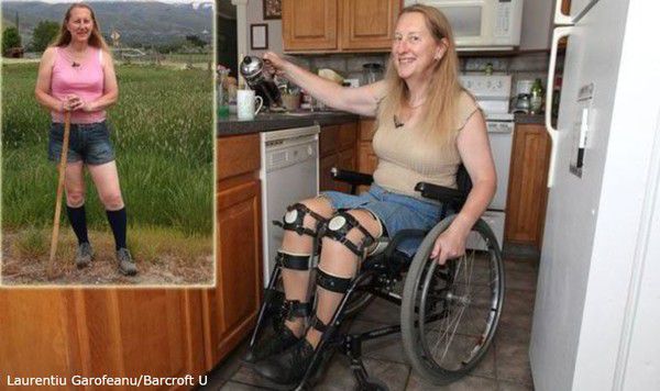 Жінка, яка може ходити, просить доктора паралізувати їй ноги! Але навіщо?. Самий дивний пацієнт в світі.