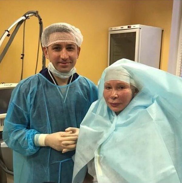 71-річна Тетяна Васильєва показала себе після підтяжки обличчя і пластики губ. Зірка часто робить пластичні операціі, бо вважає, що жінка повинна за собою стежити у будь-якому віці.